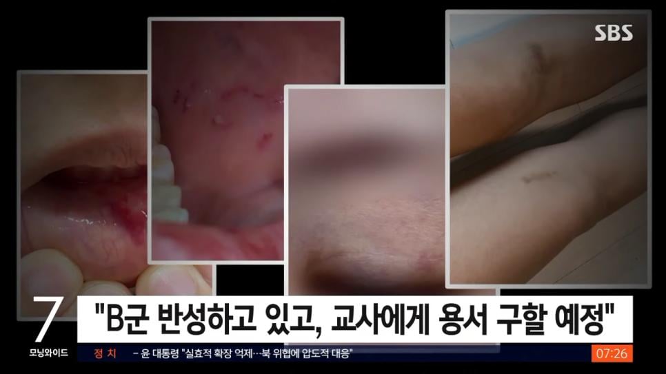 담임 폭행한 초6 뒤늦게 용서구할 예정이라고 함