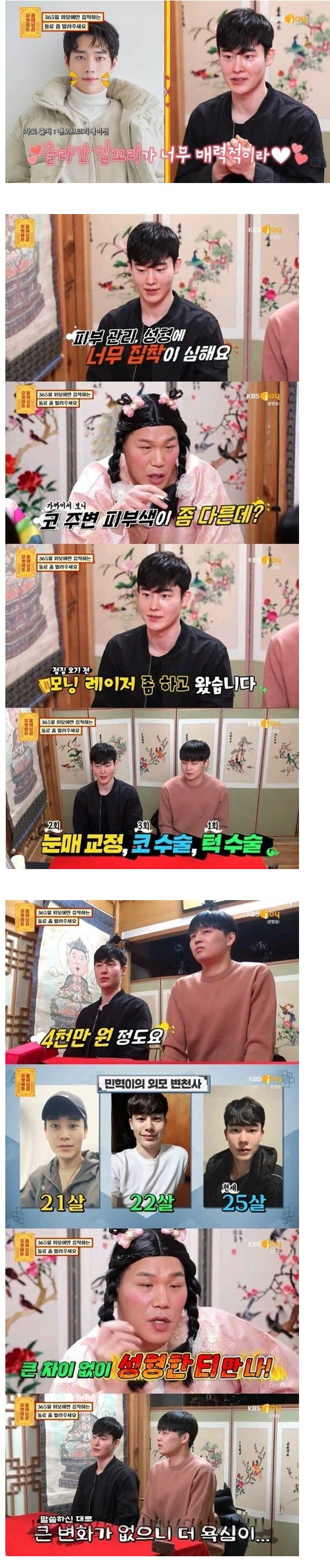 성형수술에 4천만원 쓴 남자